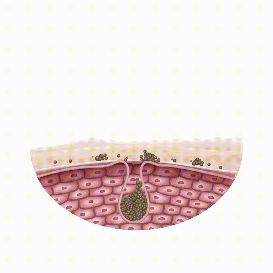 skin 2