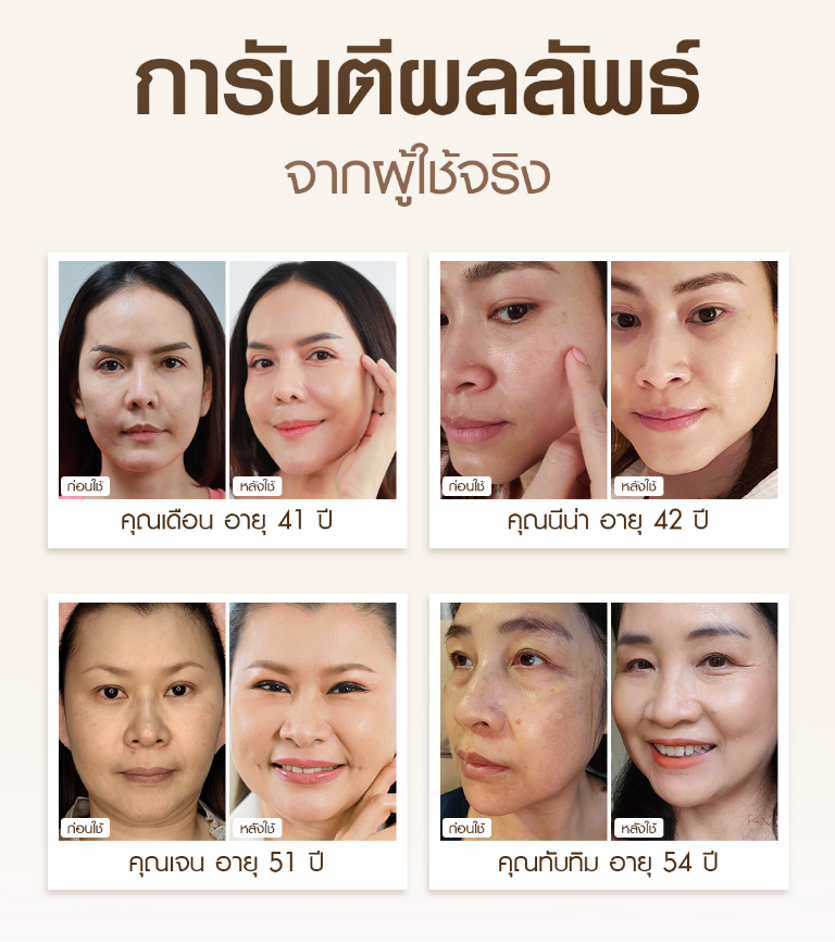 Lp re คนอวดผิว 1 10