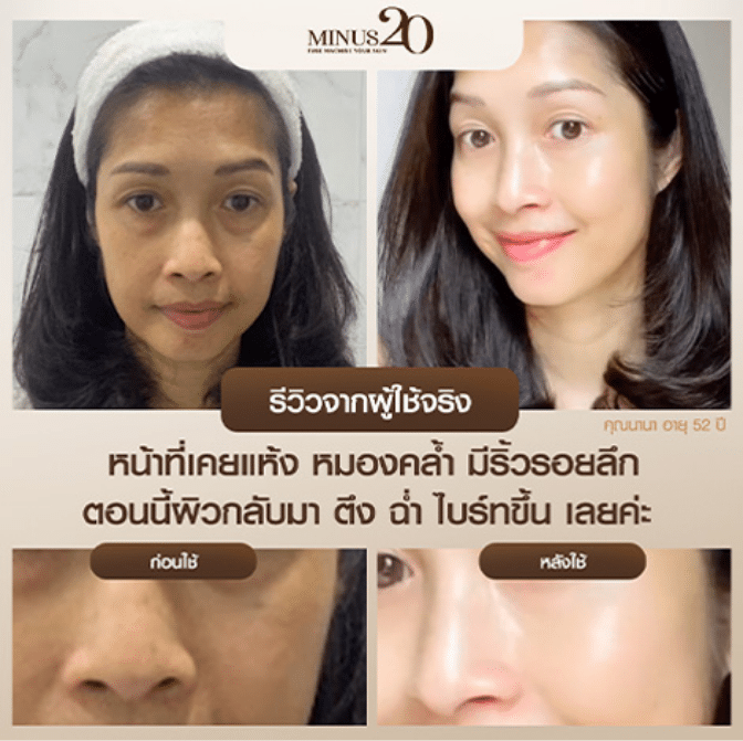 Artboard 1 copy 3