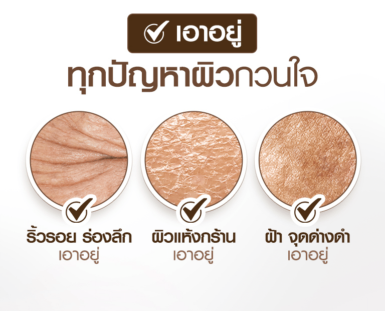 Lpครองแชมป์ 01 02