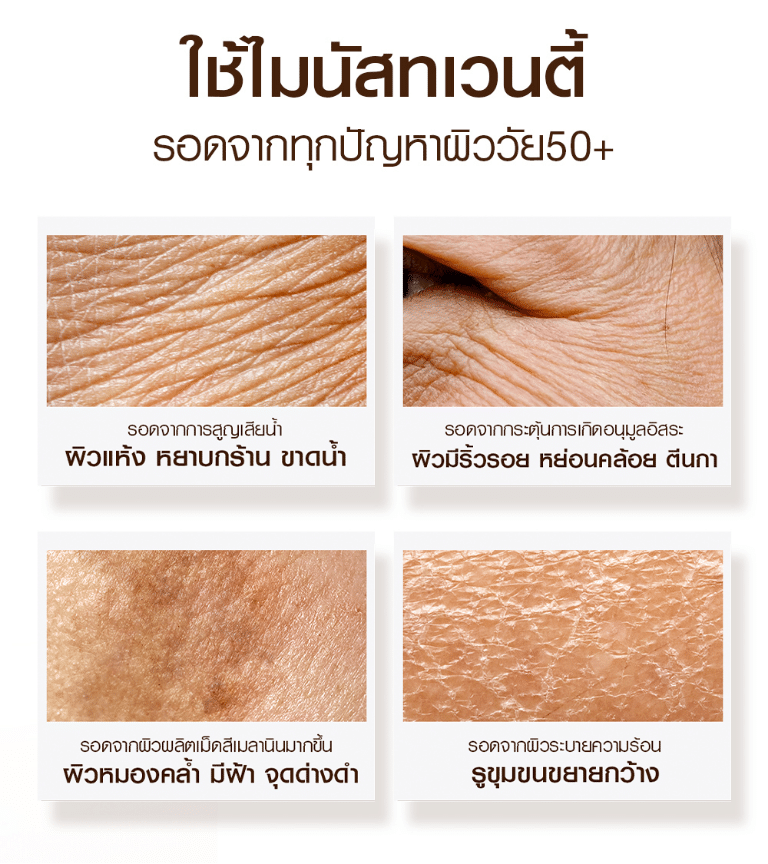 LPร้อนผิวรอด 05