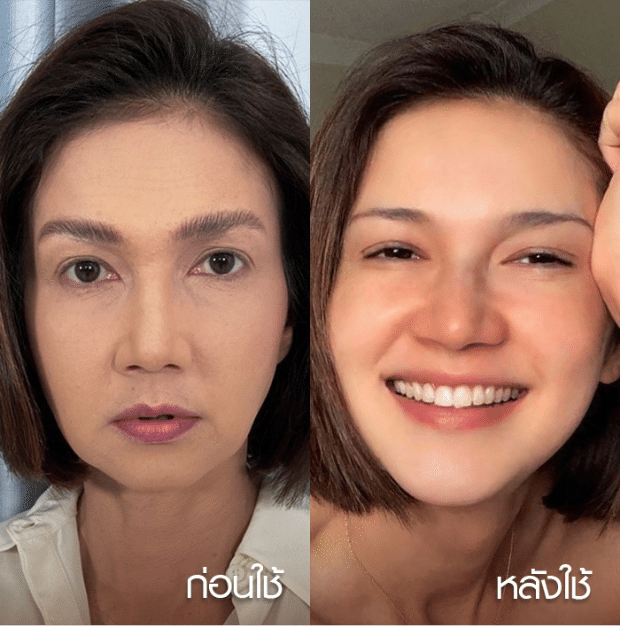 before-after-1