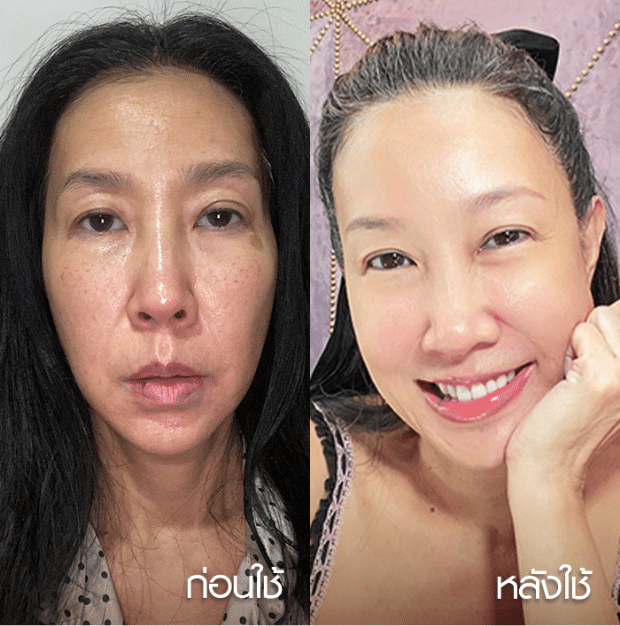 before-after-2