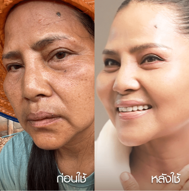 before-after-3