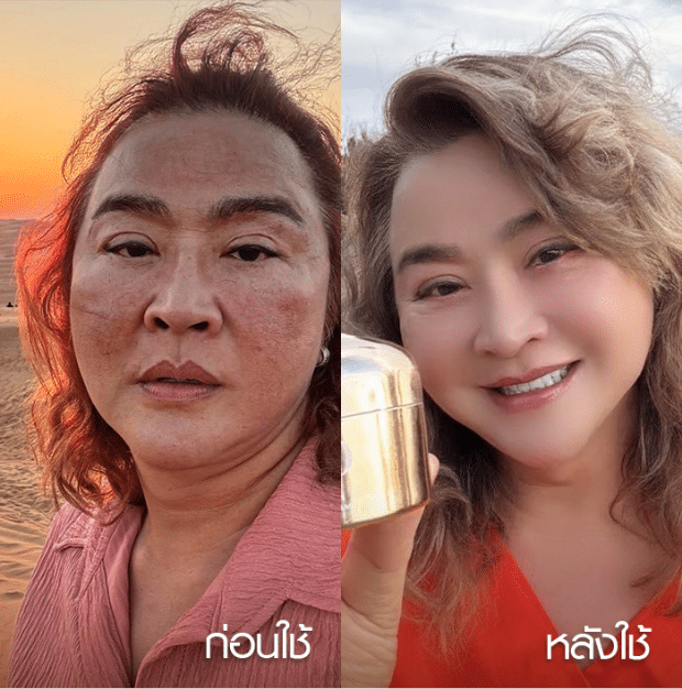 before-after-4
