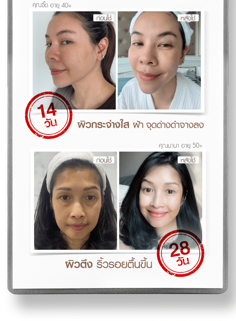 LP บอกลาผิวเก่า 12