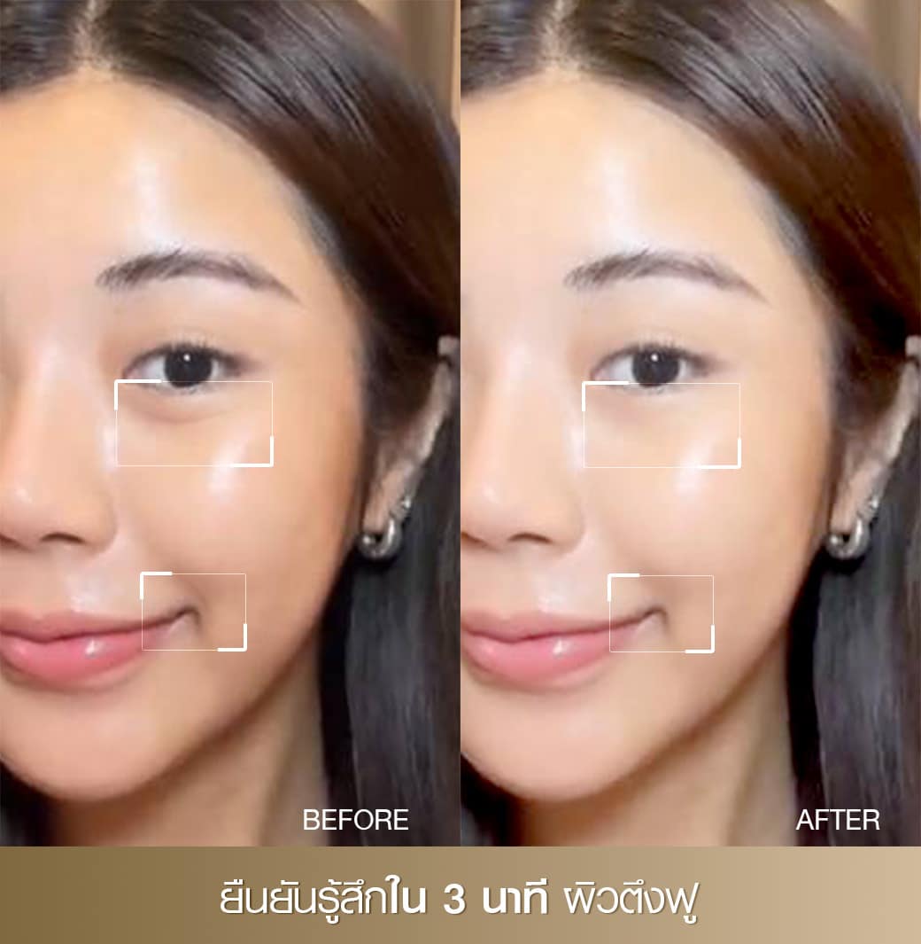 PIC-Slide-3