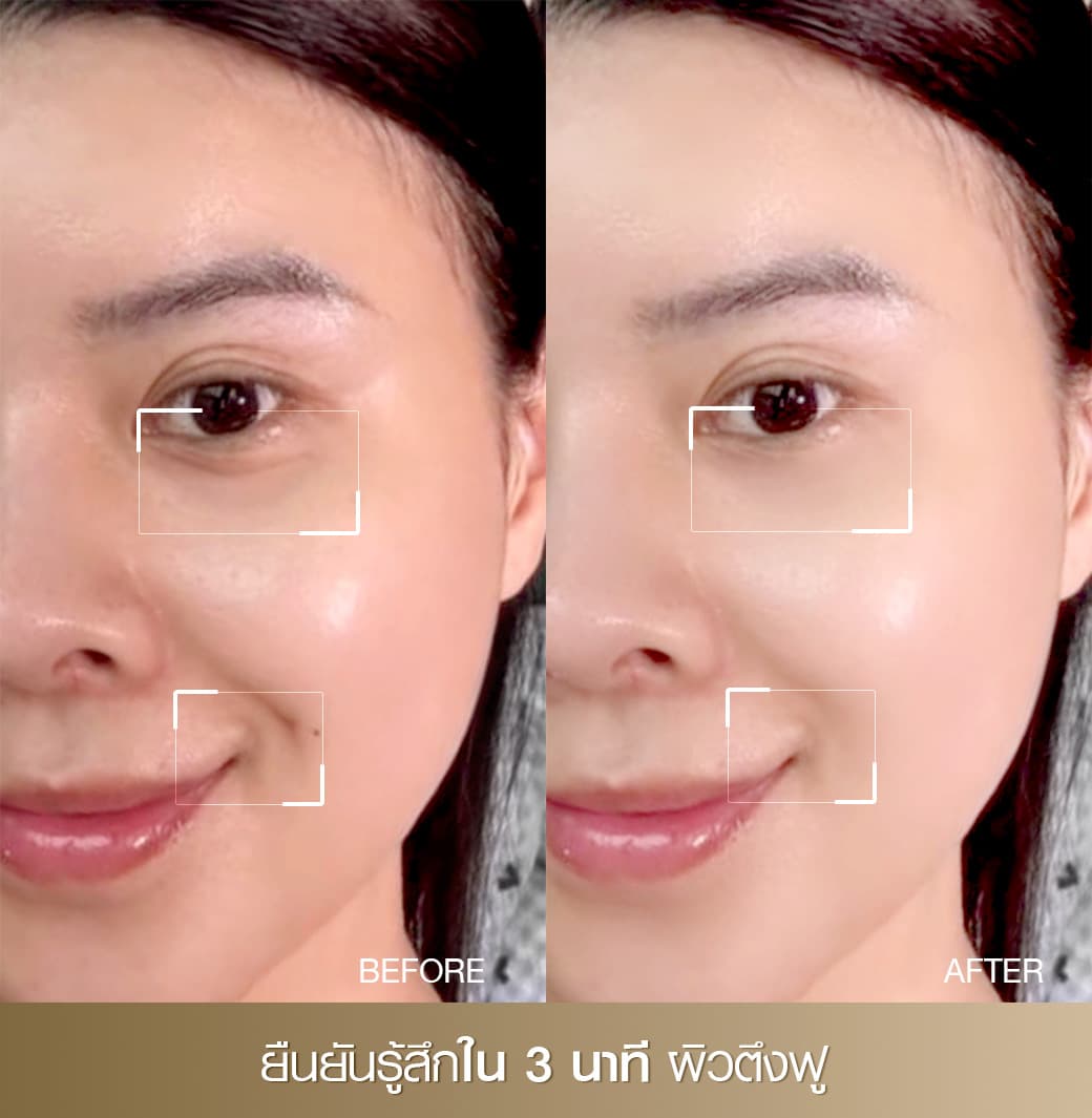 PIC-Slide-4